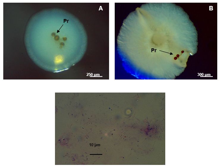 Im&aacute;genes de contaminaci&oacute;n bacteriana asociada a prop&aacute;gulos (Pr) desinfectados de INCAM - 11 (A y B). Tinci&oacute;n de Gram del contaminante m&aacute;s frecuente (C)