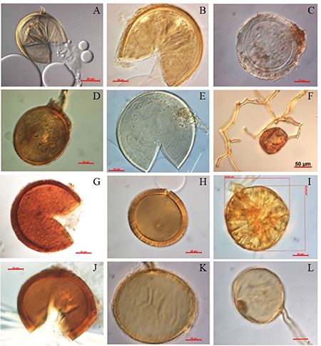 Algunas especies y morfotipos de HMA identificadas en los sitios estudiados, asociadas al cultivo del coco. (A) Acaulospora kentinensis. Barra = 50m. (B) Acaulospora morrowae. Barra = 20m. (C) Ambispora sp1. Barra = 20m. (D) Claroideoglomus claroideum. Barra = 20m. (E) Claroideoglomus etunicatum. Barra = 20m. (F) Glomus microaggregatum. Barra = 50m. (G) Glomus sp1. Barra = 20m. (H) Glomus sp2. Barra = 20m. (I) Glomus sp4. Barra = 20m. (J) Funneliformis geosporum. Barra = 20m. (K) Rhizophagus aggregatus. Barra = 20m. (L) Rhizophagus intraradices. Barra = 20m