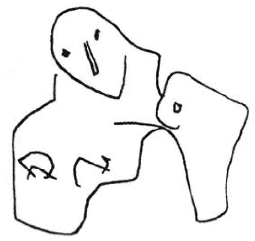 Dibujos de maternidades recogidas por Miralles en su cuaderno de notas (Miralles, 1991). Inventadas o tomadas de Moore (Miralles, 1995).