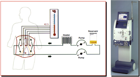 Schematic representation of the HIPEC device.