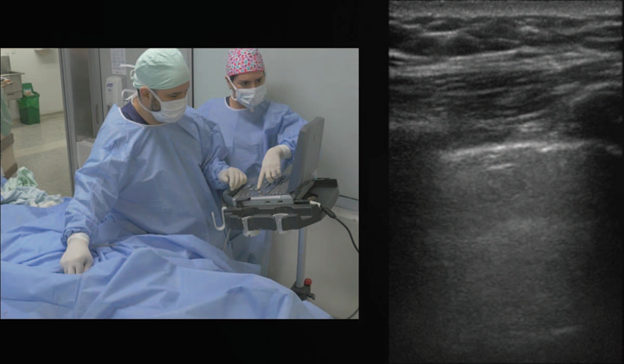 Ultrasound scan of the pleura and lung.