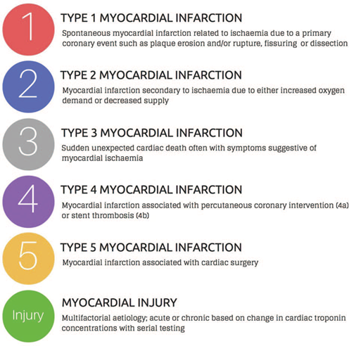 Types of acute MI according to the universal definition.