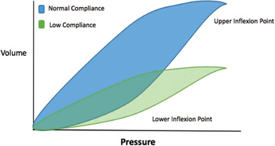 Pressure-volume loop.