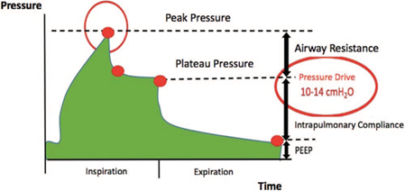 Time-pressure curve. PEEP=Positive end-expiratory pressure.