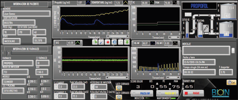 LabView 2010 platform, program for the administration of endovenous anesthesia in closed loop with BIS. BIS=bispectral index.