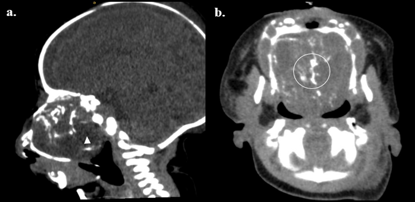Tomograf&iacute;a axial reci&eacute;n nacido.