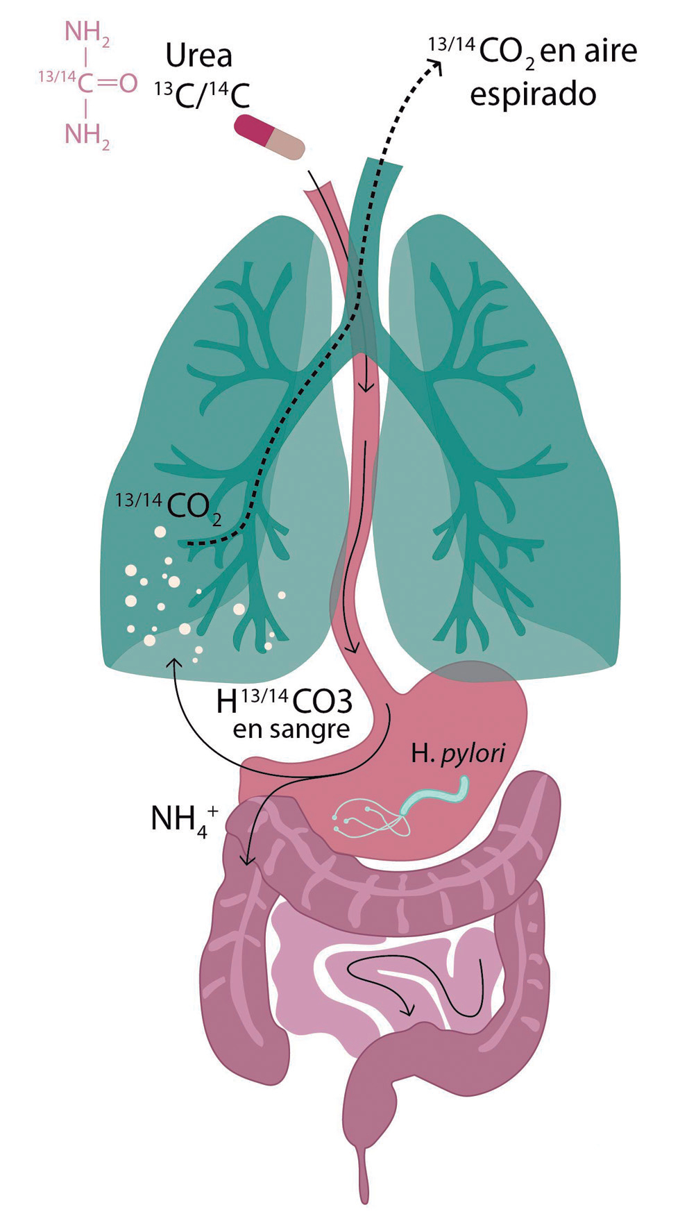 Mecanismo de deteccin de prueba de aire espirado con urea marcada con 13C o 14C. Adaptado.8,9