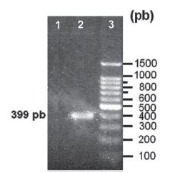 Especificidad del ensayo de PCR empleando como molde ADN cromosomal de la cepa: 1, 638; 2 C7258Kn. en 3, patrón de peso molecular de 100pb (Promega, EUA).
