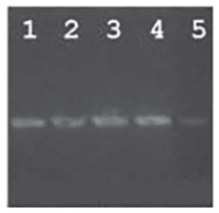 Efecto de la temperatura de hibridación en el ensayo del PCR empleando como molde el ADN de la cepa C7258Kn: 1, 45°C, 2, 50°C, 3, 55°C, 4, 60°C, 5, 45°C.