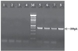 Límite de la detección del ensayo de PCR: 1, sin ADN (control de reactivos): 2, ADN de 638; 3, 10fg; 5, 1 pg; 6, 10pg y 8, 1 ng de ADN de C7258Kn. M, marcador de peso de ADN de 100 pb. (Roche, EUA)