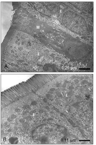 Microfotograf&iacute;as electr&oacute;nicas de transmisi&oacute;n de una secci&oacute;n de tejido intestinal a nivel de una Placa de Peyer de rat&oacute;n no infectado. A) La c&eacute;lula M (M) se diferencia de los enterocitos (E) adyacentes por sus microvellosidades m&aacute;s cortas y una mayor electrodensidad. B) Enterocitos (E) de tejido normal. 