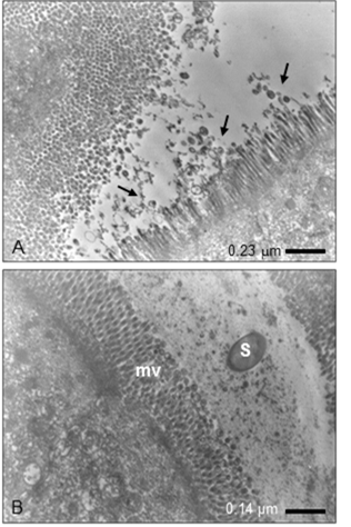 Microfotograf&iacute;as representantivas de las c&eacute;lulas epiteliales de un asa ligada de intestino de rat&oacute;n despu&eacute;s de 60 min de infecci&oacute;n por S. Typhymurium mutadas en SPI-1 (SL-1344 /∆SPI1-R y/o LMM87/∆SPI1). A) No se observan bacterias, s&oacute;lo cambios en las microvellosidades (flechas), evidenciado por da&ntilde;o en la zona apical con liberaci&oacute;n de detritos epiteliales en forma de ves&iacute;culas ovoides e irregulares. B) Salmonella (S) se encuentra distante de la superficie de las microvellosidades (mv)