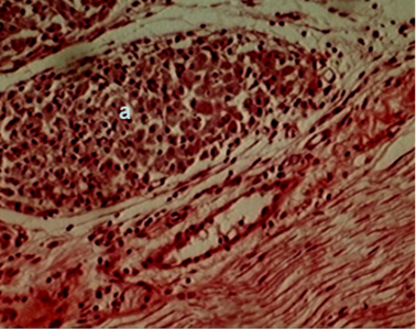 Corte histológico del sitio de administración de VAMENGOC-BC® mostrando tejido muscular con formación granulomatosa de tipo macrofágico (a) de eutanasia 28 días post-inoculación. Hematoxilina-Eosina x 120.