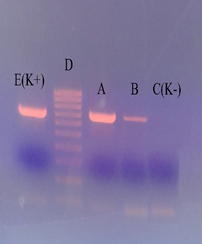 pPIC3.5-PreS2-S; B - pPIC9-PreS2-S; C (K-) - DNA isolated from the blood of HBV negative people; D - DNA line (Marker); E (K +) - DNA isolated from the blood of HBV "positive" patients.