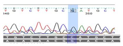 IL-6 DNA sequence chromatogram of IL-6 (rs1800795C/G) showing the heterozygous genotype of each SNP in toxoplasmosis miscarriage women.
