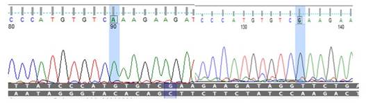 IL-1β DNA sequence of IL-1β (rs1143634 G>A) showing the heterozygous genotype of each SNP in toxoplasmosis miscarriage women. The reference sequences of SNPs denoted with A.
