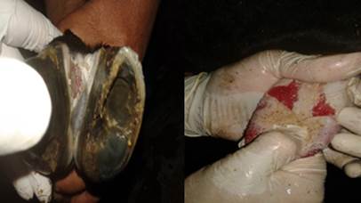 Characteristic lesions were recorded at 7th day after the challenge test.