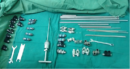 1. Fijador externo tipo Hoffmann R &reg; (imagen propia del autor).