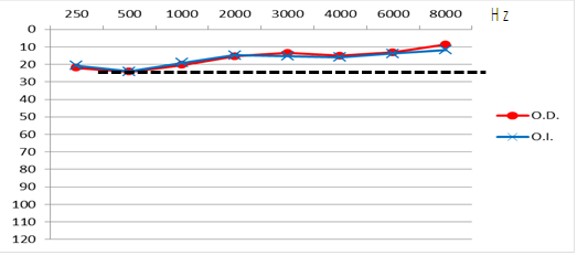 Audiometr&iacute;a tonal