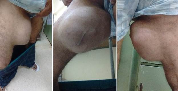 De izquierda a derecha, vista frontal, lateral y posterior.
