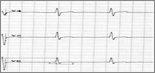Diagrama de Boston a bpm
