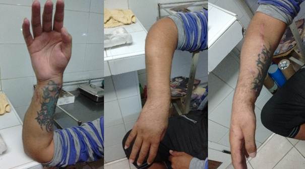 Capacidad funcional del enfermo a los seis meses