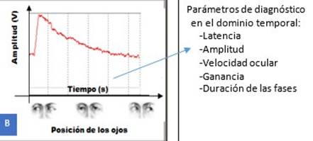 Electrooculograf&iacute;a. Cambio de posici&oacute;n de los ojos y efecto que produce en un registro el&eacute;ctrico real del nistagmo.