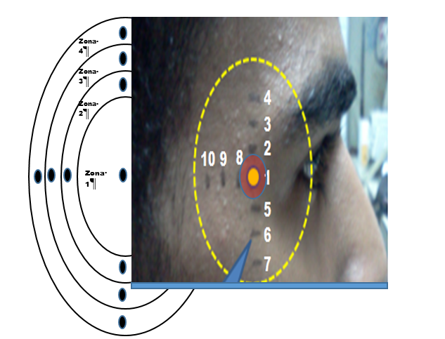 Zonas de posicionamiento del arreglo de electrodos para la captaci&oacute;n de potenciales oculares.