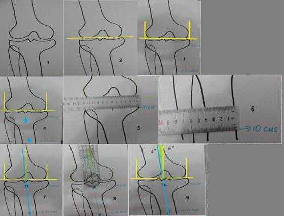 Representaci&oacute;n gr&aacute;fica del m&eacute;todo de medici&oacute;n. Pasos del uno al nueve.