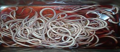 Áscaris lumbricoides extraídas.