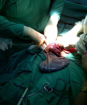 TQO de 15 cm con &aacute;reas de necrosis.