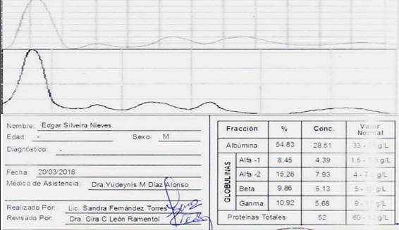 Electroforesis de prote&iacute;nas: en el esquema superior se muestra el patr&oacute;n normal, en el inferior se observa disminuci&oacute;n de la fracci&oacute;n ganma de las globulinas, representado en la banda que se encuentra m&aacute;s pr&oacute;ximo al eje horizontal. En la tabla se observan los valores absolutos de cada fracci&oacute;n. Se observ&oacute; disminuci&oacute;n de la fracci&oacute;n ganma de las globulinas e Hipoalbuminemia.