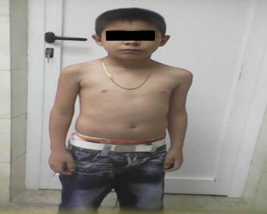 Se realiz&oacute; evaluaci&oacute;n nutricional pr&oacute;xima al alta hospitalaria. Se constat&oacute; recuperaci&oacute;n nutricional, con ganancia de cinco kilogramos de peso.