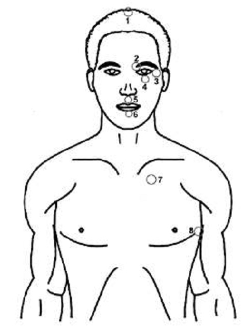 Acupoints of EFT