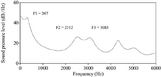 Espectro LPC de la consonante [λ] en posici�n inicial de palabra en la palabra [λaɲu] ('delgado, suave, fino')