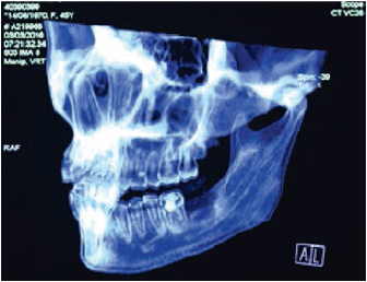 Reconstrucci&oacute;n en 3D prequir&uacute;rgico