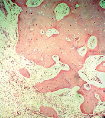 Corte
histol&oacute;gico a 10X