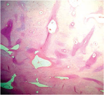 Corte
histol&oacute;gico a 4X