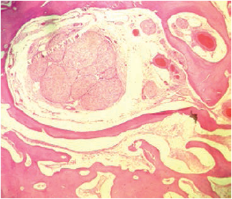 Corte
histol&oacute;gico a 4X