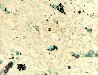 Coloraci&oacute;n
de plata. Aumento 100X con aceite de inmersi&oacute;n