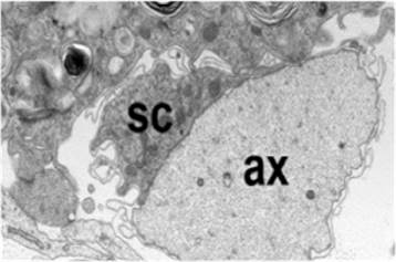 Micrograf&iacute;a electr&oacute;nica de un nervio sano murino que muestra un ax&oacute;n (ax) y su
c&eacute;lula de Schwann (SC) intactos