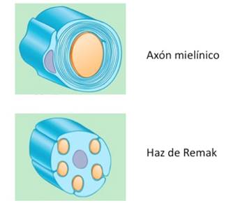 Factores
de transcripci&oacute;n que promueven el estado promielinizante. Las c&eacute;lulas de Schwann
adquieren asociaci&oacute;n uno a uno con el ax&oacute;n (ax&oacute;n miel&iacute;nico). Otras c&eacute;lulas de Schwann
permanecen amiel&iacute;nicas agregando m&uacute;ltiples axones (haces de Remak)