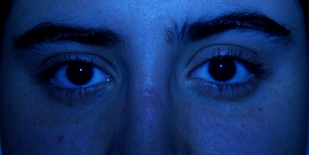 Reflejo de
Hirschberg centrado (ortoforia)