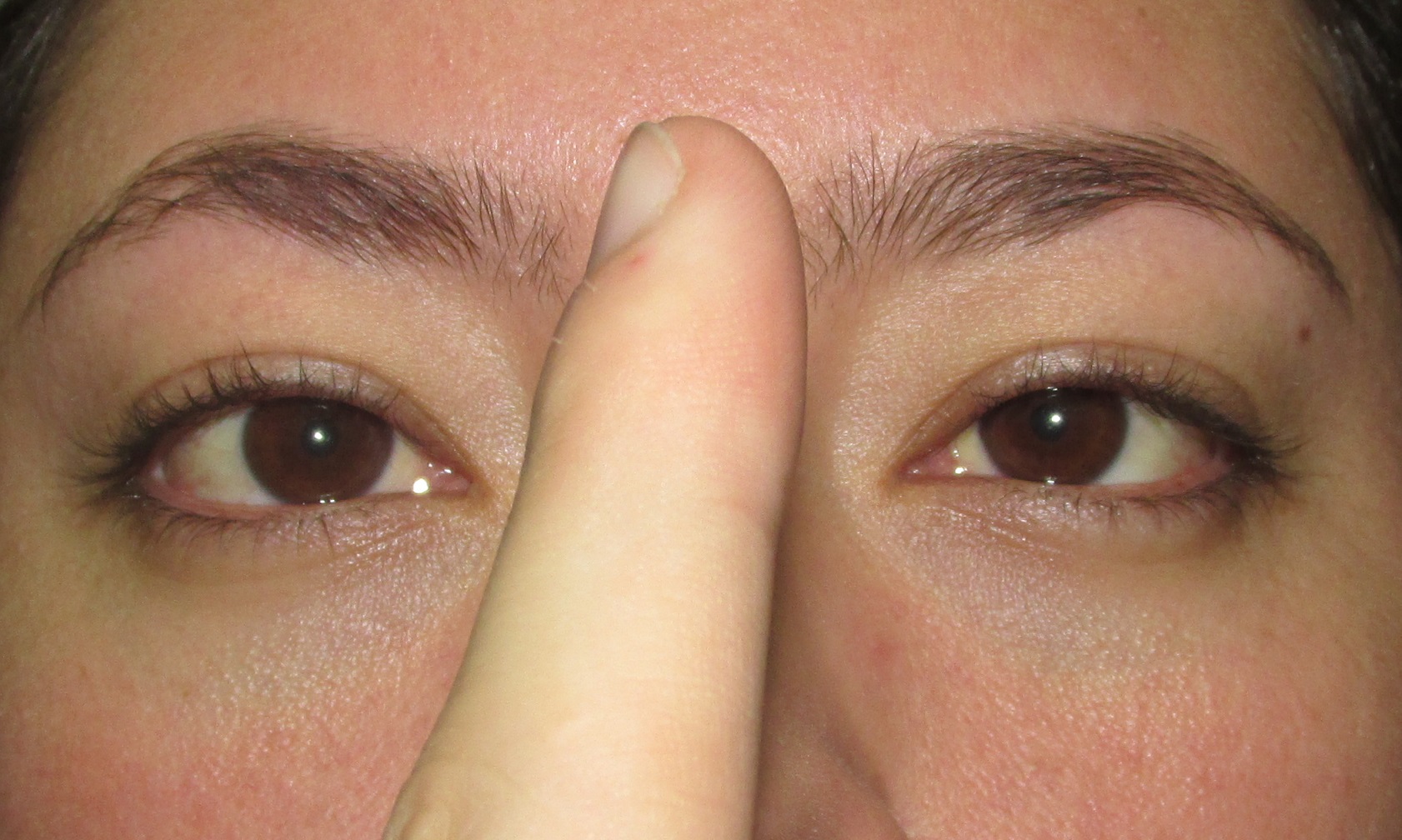 Examen de
la convergencia ocular por medio de la fijaci&oacute;n en un objeto que se acerca