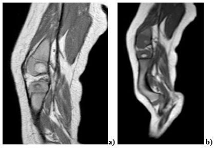 Resonancia magn&eacute;tica (DP)