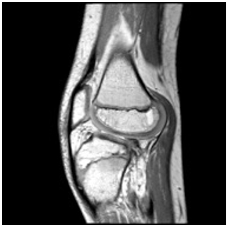 Resonancia magn&eacute;tica (DP)