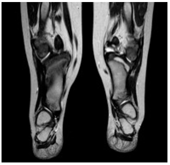 Resonancia magn&eacute;tica en T2