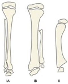 Clasificaci&oacute;n de Achterman y Kalamachi para hemimelia fibular