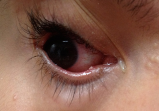 Seguimiento del paciente. Corresponde
a nuestro paciente.