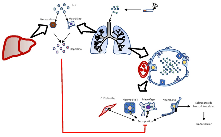 Fisiopatolog&iacute;a d&eacute;ficit de hierro en la EPOC: la hepcidina
no solo inhibe la acci&oacute;n de la ferroportina en el
intestino, como lo muestra la figura, sino que las c&eacute;lulas que se encuentran en
el espacio alveolar y su alrededor tambi&eacute;n son afectadas por la acci&oacute;n de esta
hormona.